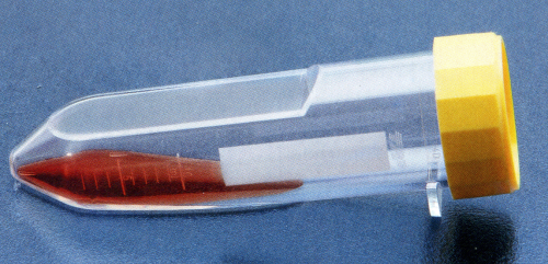 zellkulturflachroehrchen_mit_f zellkulturflachroehrchen_mit_f